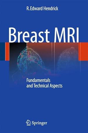 Image du vendeur pour Breast MRI mis en vente par moluna