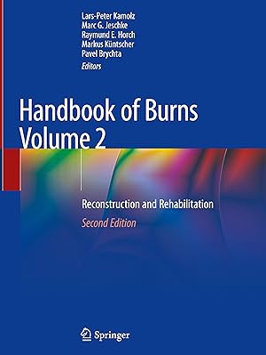 Image du vendeur pour Handbook of Burns Volume 2 mis en vente par moluna