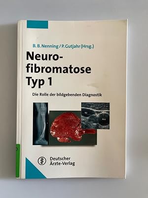 Bild des Verkufers fr Neurofibromatose Typ 1: Die Rolle der bildgebenden Diagnostik. zum Verkauf von Wissenschaftl. Antiquariat Th. Haker e.K