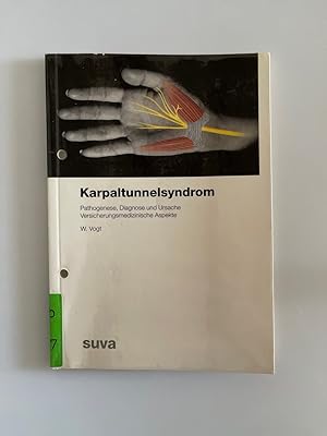 Karpaltunnelsyndrom: Pathogenese, Diagnose und Ursache - Versicherungsmedizinische Aspekte.