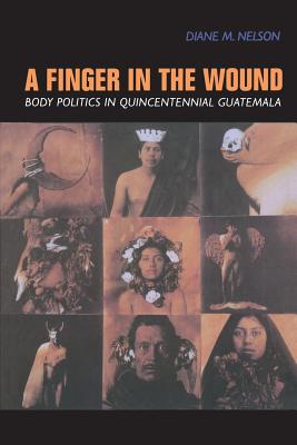 Seller image for A Finger in the Wound: Body Politics in Quincentennial Guatemala (Paperback or Softback) for sale by BargainBookStores