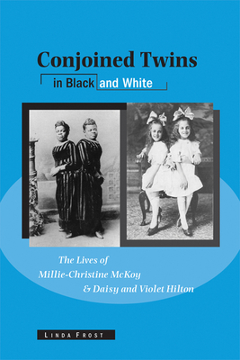 Image du vendeur pour Conjoined Twins in Black and White: The Lives of Millie-Christine McKoy and Daisy and Violet Hilton (Paperback or Softback) mis en vente par BargainBookStores