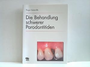 Seller image for Die Behandlung schwerer Parodontitiden for sale by Celler Versandantiquariat