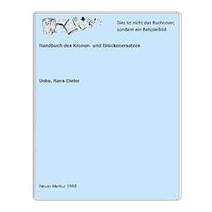 Bild des Verkufers fr Handbuch des Kronen- und Brckenersatzes zum Verkauf von Celler Versandantiquariat