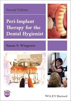 Immagine del venditore per Peri-Implant Therapy for the Dental Hygienist venduto da moluna