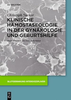 Bild des Verkufers fr Klinische Hmostaseologie in der Gynkologie und Geburtshilfe zum Verkauf von AHA-BUCH GmbH