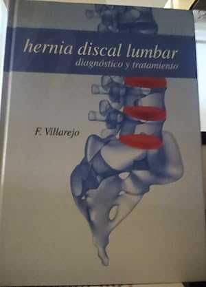 HERNIA DISCAL LUMBAR Diagnóstico y tratamiento