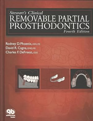 Imagen del vendedor de Stewart's Clinical Removable Partial Prosthodontics a la venta por GreatBookPricesUK