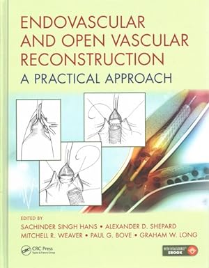 Bild des Verkufers fr Endovascular and Open Vascular Reconstruction : A Practical Approach zum Verkauf von GreatBookPricesUK