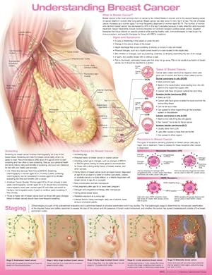 Imagen del vendedor de Understanding Breast Cancer Anatomical Chart a la venta por GreatBookPrices