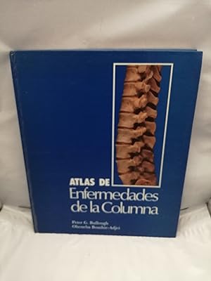 Bild des Verkufers fr Atlas de Enfermedades de la Columna zum Verkauf von Libros Angulo
