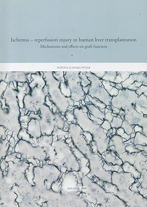 Ischemia : Reperfusion Injury in Human Liver Transplantation : Mechanisms and Effects on Graft Fu...