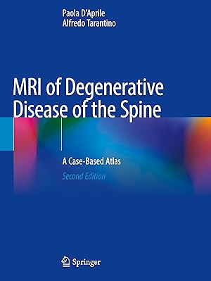 Image du vendeur pour MRI of Degenerative Disease of the Spine mis en vente par moluna