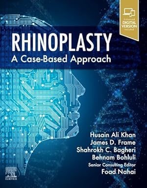 Bild des Verkufers fr Rhinoplasty : A Case-based Approach zum Verkauf von GreatBookPricesUK