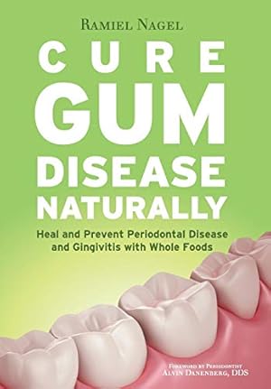 Bild des Verkufers fr Cure Gum Disease Naturally: Heal Gingivitis and Periodontal Disease with Whole Foods zum Verkauf von Pieuler Store