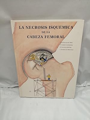 Bild des Verkufers fr La necrosis isqumica de la cabeza femoral zum Verkauf von Libros Angulo