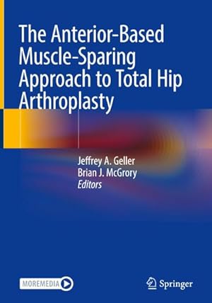 Bild des Verkufers fr The Anterior-Based Muscle-Sparing Approach to Total Hip Arthroplasty zum Verkauf von AHA-BUCH GmbH