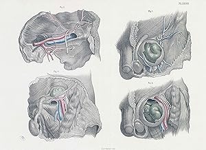 Imagen del vendedor de 1856 Large Antique lithograph SURGICAL ANATOMY Penis Testicles Maclise (SA-2) a la venta por Antique Paper Company