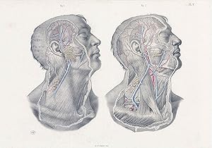 Imagen del vendedor de 1856 Lithograph SURGICAL ANATOMY Dissection of the Neck Maclise (SA-42) a la venta por Antique Paper Company