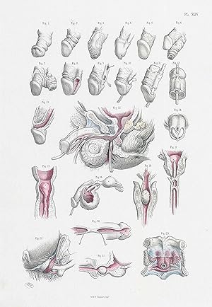 Imagen del vendedor de 1856 Large Antique lithograph SURGICAL ANATOMY Penis Genitalia Maclise (SA-8) a la venta por Antique Paper Company