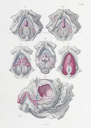 Imagen del vendedor de 1856 Lithograph SURGICAL ANATOMY Pelvis Male Urogenital System Maclise (SA-6) a la venta por Antique Paper Company