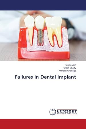 Seller image for Failures in Dental Implant for sale by moluna