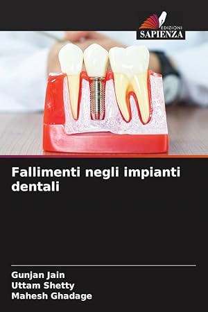 Seller image for Fallimenti negli impianti dentali for sale by moluna