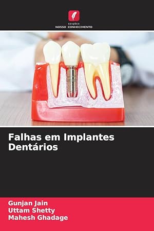 Seller image for Falhas em Implantes Dentrios for sale by moluna