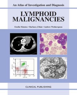 Seller image for Lymphoid Malignancies: v. 1 (Atlas of Investigation and Management) for sale by WeBuyBooks