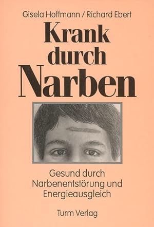 Krank durch Narben : gesund durch Narbenentstörung und Energieausgleich / Gisela Hoffmann/Richard...