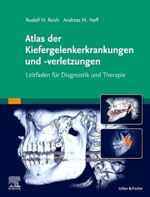 Bild des Verkufers fr Atlas der Kiefergelenkerkrankungen und -verletzungen : Leitfaden fr Diagnostik und Therapie zum Verkauf von AHA-BUCH GmbH