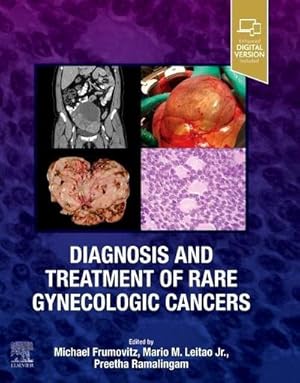 Bild des Verkufers fr Diagnosis and Treatment of Rare Gynecologic Cancers zum Verkauf von AHA-BUCH GmbH