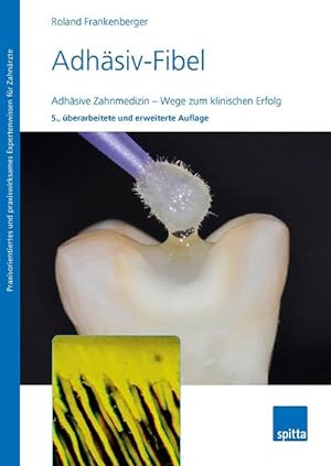 Seller image for Adhsiv-Fibel : Adhsive Zahnmedizin - Wege zum klinischen Erfolg for sale by AHA-BUCH GmbH