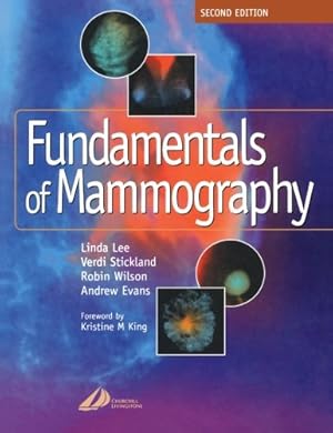 Seller image for Fundamentals of Mammography by Lee, Linda, Stickland, Verdi, Wilson MBChB FRCR FRCP(E), A. Robin M., Evans, Andrew [Paperback ] for sale by booksXpress