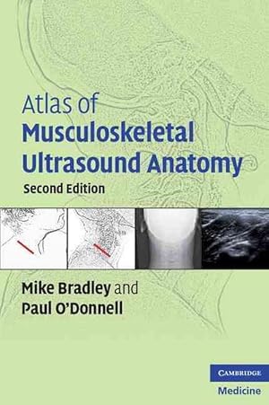 Seller image for Atlas of Musculoskeletal Ultrasound Anatomy (Paperback) for sale by CitiRetail