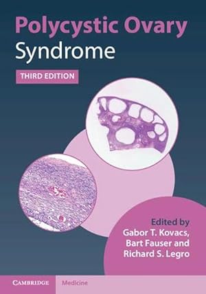 Image du vendeur pour Polycystic Ovary Syndrome (Hardcover) mis en vente par CitiRetail