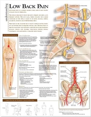 Immagine del venditore per Understanding Low Back Pain Anatomical Chart - Paper Unmounted (Wall) venduto da CitiRetail