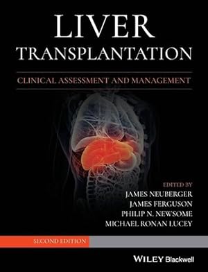 Seller image for Liver Transplantation (Hardcover) for sale by CitiRetail