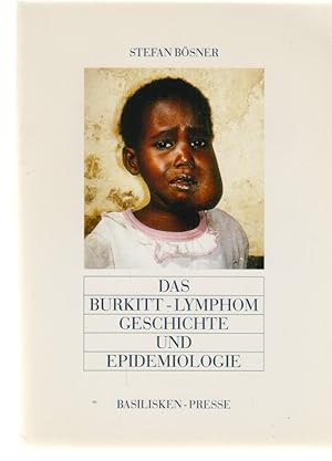 Bild des Verkufers fr Das Burkitt-Lymphom : Erforschungsgeschichte und Epidemiologie. zum Verkauf von Fundus-Online GbR Borkert Schwarz Zerfa