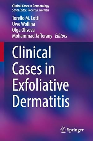 Bild des Verkufers fr Clinical Cases in Exfoliative Dermatitis zum Verkauf von AHA-BUCH GmbH