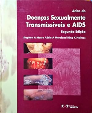 Bild des Verkufers fr ATLAS DE DOENAS SEXUALMENTE TRANSMISSVEIS E AIDS. zum Verkauf von Livraria Castro e Silva