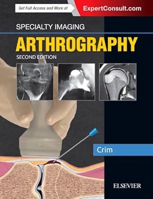 Seller image for Arthrography for sale by GreatBookPricesUK