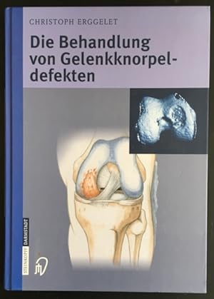 Immagine del venditore per Die Behandlung von Gelenkknorpeldefekten. venduto da Antiquariat Im Seefeld / Ernst Jetzer