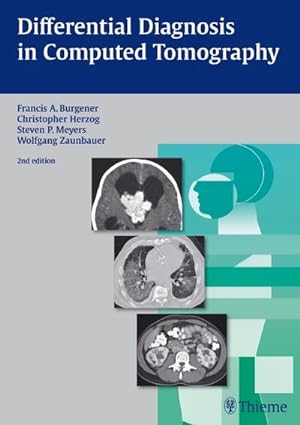 Bild des Verkufers fr Differential diagnosis in computed tomography. zum Verkauf von CSG Onlinebuch GMBH