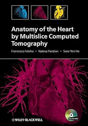 Seller image for Anatomy of the Heart by Multislice Computed Tomography, for sale by CSG Onlinebuch GMBH