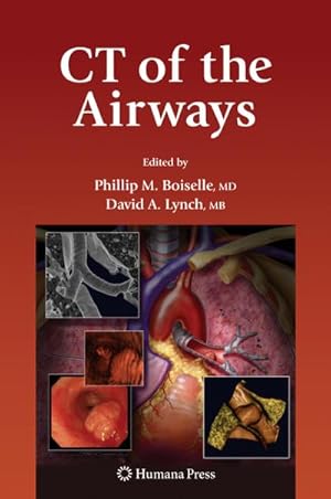 Seller image for CT of the Airways, for sale by CSG Onlinebuch GMBH