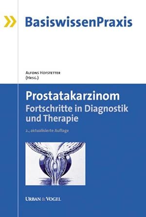 Seller image for Prostatakarzinom. for sale by CSG Onlinebuch GMBH