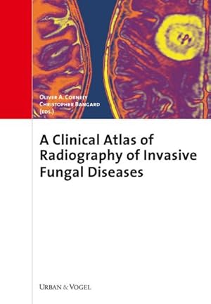 Bild des Verkufers fr A Clinical Atlas of Radiography of Invasive Fungal Diseases, zum Verkauf von CSG Onlinebuch GMBH