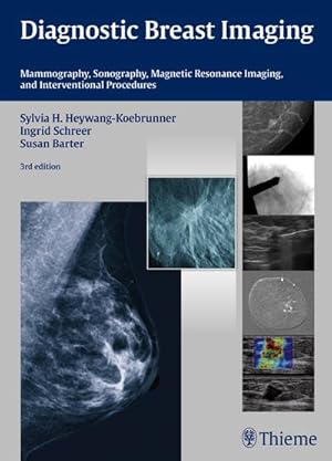 Image du vendeur pour Diagnostic breast imaging : mammography, sonography, magnetic resonance imaging, and interventional procedures. mis en vente par CSG Onlinebuch GMBH