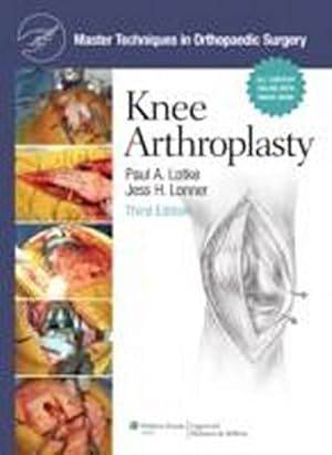 Image du vendeur pour Master Techniques in Orthopaedic Surgery: Knee Arthroplasty mis en vente par CSG Onlinebuch GMBH